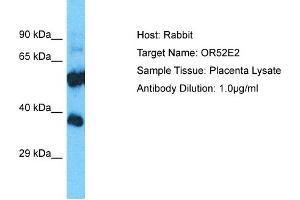 Host: Rabbit Target Name: OR52E2 Sample Type: Placenta lysates Antibody Dilution: 1.