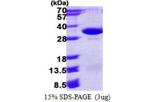 SDS-PAGE (SDS) image for Proteasome Subunit alpha 4 (PSMA4) (AA 1-261) protein (His tag) (ABIN666616)