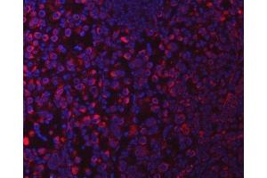 IF analysis of SUCLG1 using anti-SUCLG1 antibody (ABIN7600906).