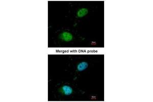 ICC/IF Image Immunofluorescence analysis of paraformaldehyde-fixed HeLa, using Scaffold attachment factor B1, antibody at 1:100 dilution.
