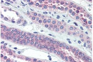 Human Kidney (formalin-fixed, paraffin-embedded) stained with TJP3 antibody ABIN364296 at 10 ug/ml followed by biotinylated goat anti-rabbit IgG secondary antibody ABIN481713, alkaline phosphatase-streptavidin and chromogen. (TJP3 antibody  (C-Term))