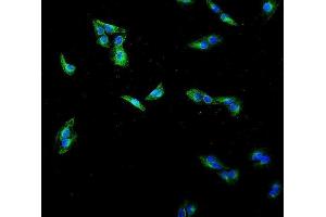 IF analysis of Beta Tubulin using anti-Beta Tubulin antibody (ABIN7602743). (TUBB antibody  (C-Term))