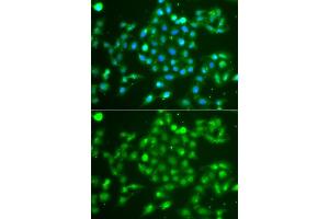 Immunofluorescence analysis of  cells using UCHL5 antibody (ABIN6132764, ABIN6149872, ABIN6149874 and ABIN6223990). (UCHL5 antibody  (AA 1-328))