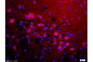 Formalin-fixed and paraffin-embedded rat brain labeled with Anti-KMT8/Riz1/Riz2 Polyclonal Antibody, Unconjugated (ABIN763001) 1:200, overnight at 4°C, The secondary antibody was Goat Anti-Rabbit IgG, Cy3 conjugated used at 1:200 dilution for 40 minutes at 37°C. (PRDM2 antibody  (AA 1201-1300))