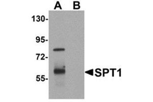 Western blot analysis of TYW1 in human lung tissue lysate with TYW1 antibody at 1 μg/ml. (TYW1 antibody  (C-Term))