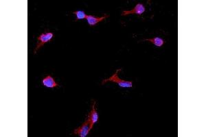 IF analysis of IGFBP2 using anti-IGFBP2 antibody (ABIN5693239).