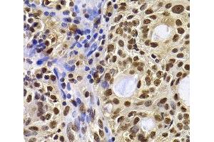 Immunohistochemistry (Paraffin-embedded Sections) (IHC (p)) image for anti-HIRA Interacting Protein 3 (HIRIP3) antibody (ABIN7262957)