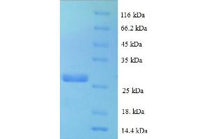 Chemokine (C-C Motif) Ligand 16 (CCL16) (AA 24-120) protein (His-SUMO Tag)