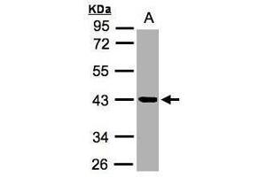 WB Image Sample (30μg whole cell lysate) A:MOLT4 , 10% SDS PAGE antibody diluted at 1:2000 (Kallikrein 11 antibody)
