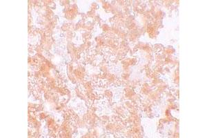 Immunohistochemical staining of rat lung cells with MFSD2 polyclonal antibody  at 5 ug/mL.