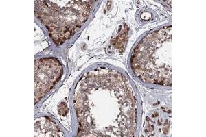 Immunohistochemical staining of human testis with N4BP1 polyclonal antibody  shows strong cytoplasmic positivity in cells in seminiferus ducts / spermatogonia at 1:50-1:200 dilution.