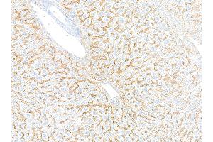 Immunohistochemistry (IHC) image for anti-Epidermal Growth Factor Receptor (EGFR) (C-Term) antibody (ABIN7795642) (Recombinant EGFR antibody  (C-Term))