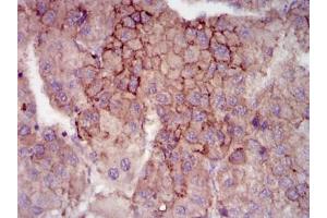 Immunohistochemistry (IHC) image for anti-Maternal Embryonic Leucine Zipper Kinase (MELK) antibody (ABIN1108210) (MELK antibody)