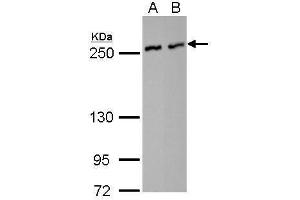 WB Image NuMA antibody [N1], N-term detects NUMA1 protein by Western blot analysis.