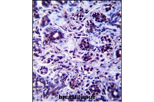 DHX32 Antibody (Center) (ABIN657498 and ABIN2846523) immunohistochemistry analysis in formalin fixed and paraffin embedded human breast tissue followed by peroxidase conjugation of the secondary antibody and DAB staining. (DHX32 antibody  (AA 342-371))