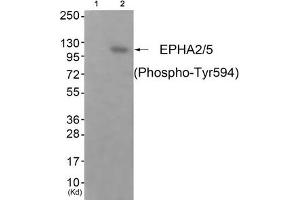 Western blot analysis of extracts from JK cells (Lane 2), using EPHA2/5 (Phospho-Tyr594) Antibody. (EPHA2/EPHA5 (pTyr594) antibody)