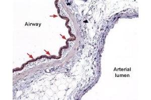 Expression of Sphingosine 1-phosphate receptor 2 in rat lung - Immunohistochemical staining of paraffin embedded rat lung sections using Anti-S1PR2 (EDG5) Antibody (ABIN7043773, ABIN7045272 and ABIN7045273), (1:100). (S1PR2 antibody  (2nd Cytoplasmic Loop))