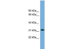 WB Suggested Anti-MRPS2  Antibody Titration: 0. (MRPS2 antibody  (Middle Region))
