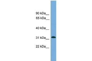 WB Suggested Anti-MRPS2  Antibody Titration: 0.