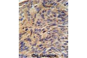 Immunohistochemistry (IHC) image for anti-Heat Shock 70kDa Protein 5 (Glucose-Regulated Protein, 78kDa) (HSPA5) antibody (ABIN3002214)