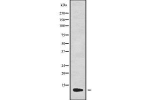 Western blot analysis of CCL13 using MCF7 whole cell lysates (CCL13 antibody)