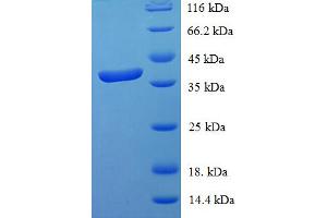 SDS-PAGE (SDS) image for Signal Transducer and Activator of Transcription 3 (Acute-Phase Response Factor) (STAT3) (AA 50-240), (partial) protein (His-SUMO Tag) (ABIN5710422)