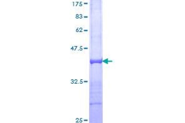 SORL1 Protein (AA 82-181) (GST tag)