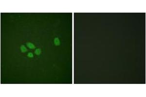 Immunofluorescence analysis of A549 cells, using SOX-9 (Phospho-Ser181) Antibody. (SOX9 antibody  (pSer181))