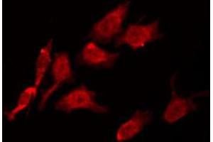ABIN6274225 staining Hela by IF/ICC. (LTK antibody  (Internal Region))