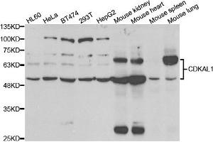 Western blot analysis of extracts of various cell lines, using CDKAL1 antibody.