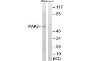 Western blot analysis of extracts from HeLa cells, treated with TSA 400nM 24H, using PAK2 (Ab-141) Antibody.