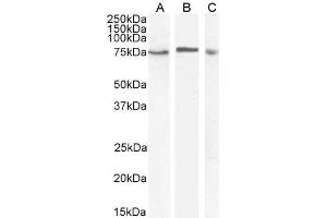 ABIN185640 (1µg/ml) staining of HeLa (A) and U937 (B) and (2ug/ml) Daudi (C) cell lysate (35µg protein in RIPA buffer). (MAP3K7 antibody  (Internal Region))