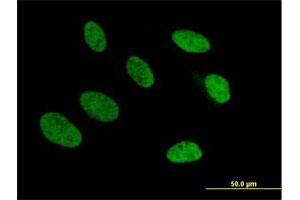 Immunofluorescence of purified MaxPab antibody to TRA2A on HeLa cell.