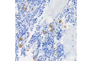 Immunohistochemistry of paraffin-embedded rat bone marrow using NOX2/gp91phox antibody (ABIN3022299, ABIN3022300, ABIN3022301 and ABIN6218718) at dilution of 1:200 (40x lens). (CYBB antibody  (AA 283-570))