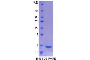 SDS-PAGE analysis of Human CHRNa1 Protein.