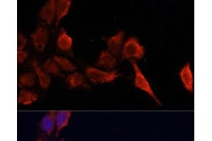 Immunofluorescence analysis of HeLa cells using TIMP1 Polyclonal Antibody at dilution of 1:100.