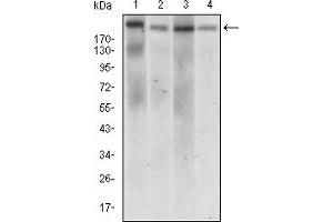 Fig. (DNMT1 antibody  (AA 1448-1594))