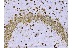 IHC analysis of BRSK1 using anti-BRSK1 antibody (ABIN7600990). (BRSK1 antibody  (AA 269-321))