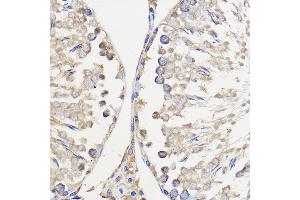 Immunohistochemistry of paraffin-embedded Rat testis using WBSCR27 Rabbit pAb (ABIN7271366) at dilution of 1:50 (40x lens). (WBSCR27 antibody  (AA 1-245))