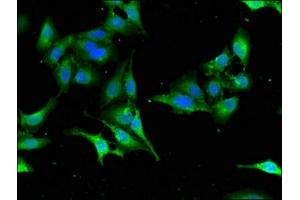 Immunofluorescent analysis of Hela cells using ABIN7168659 at dilution of 1:100 and Alexa Fluor 488-congugated AffiniPure Goat Anti-Rabbit IgG(H+L) (SEC23IP antibody  (AA 779-989))