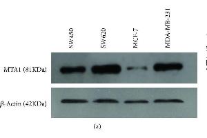 Protein expression of MTA1 by Western Blot analysis. (MTA1 antibody  (AA 601-715))