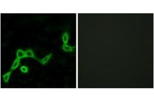 Immunofluorescence analysis of LOVO cells, using KISS1R Antibody. (KISS1R antibody  (AA 301-350))