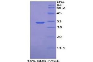 SDS-PAGE analysis of Mouse PCK1 Protein.