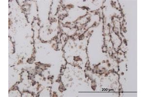 Immunoperoxidase of monoclonal antibody to FOXL1 on formalin-fixed paraffin-embedded human lung. (FOXL1 antibody  (AA 132-240))