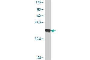 Western Blot detection against Immunogen (37. (DLG5 antibody  (AA 1708-1809))