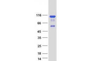 Validation with Western Blot (OSBPL9 Protein (Transcript Variant 7) (Myc-DYKDDDDK Tag))