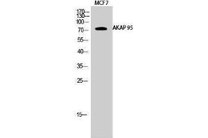 Western Blotting (WB) image for anti-A Kinase (PRKA) Anchor Protein 8 (AKAP8) (Internal Region) antibody (ABIN3183225) (AKAP8 antibody  (Internal Region))