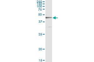 Immunoprecipitation of CRLF1 transfected lysate using anti-CRLF1 monoclonal antibody and Protein A Magnetic Bead , and immunoblotted with CRLF1 MaxPab rabbit polyclonal antibody. (CRLF1 antibody  (AA 135-230))