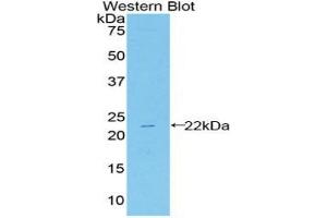 Detection of Recombinant HSPb2, Mouse using Polyclonal Antibody to Heat Shock Protein Beta 2 (HSPb2) (HSPB2 antibody  (AA 12-170))
