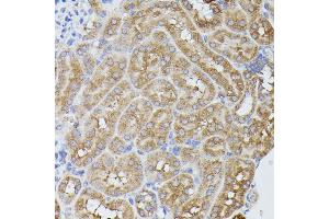 Immunohistochemistry of paraffin-embedded mouse kidney using PP2A-B56δ/PR61δ/PP2A-B56δ/PR61δ/PPP2R5D antibody (ABIN7269690) at dilution of 1:100 (40x lens).